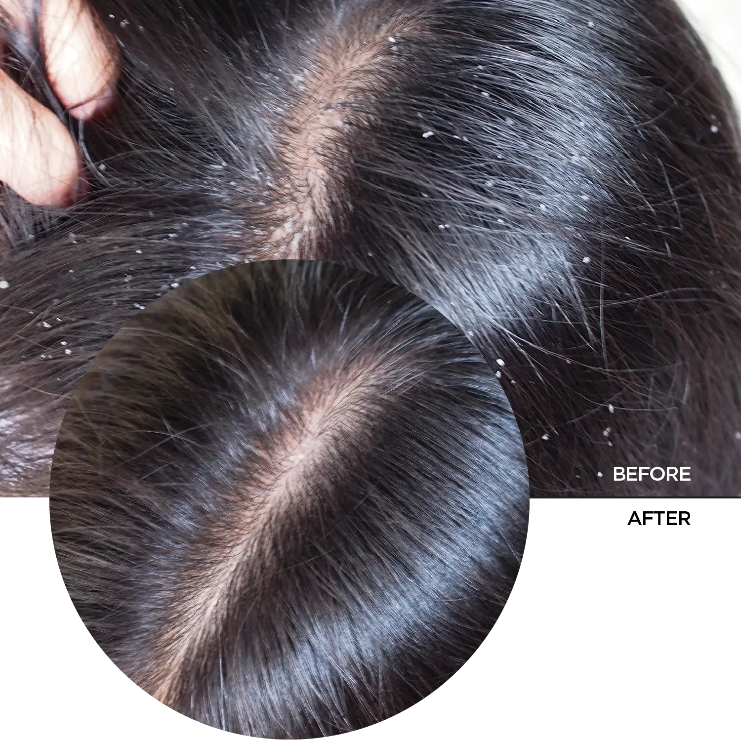 Hyaluronic Acid 2% for Hair